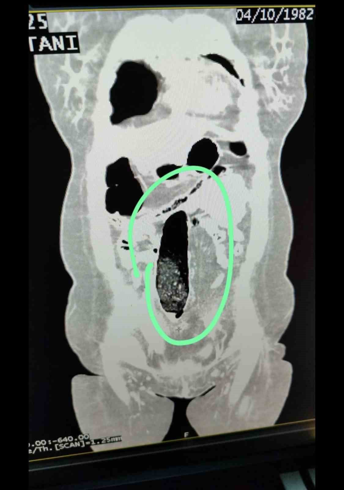MUŞ İL EMNİYET MÜDÜRLÜĞÜ EKİPLERİNCE ŞEHİRLER ARASI OTOBÜSTE YAKALANAN 2 İRAN UYRUKLU ŞAHSIN...