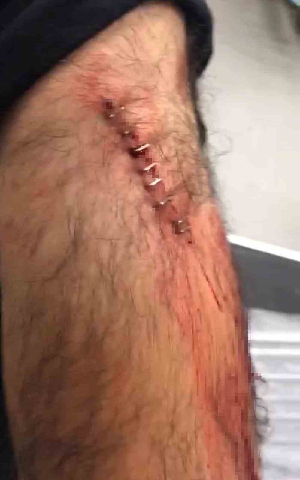 ŞANLIURFA’DA GÖREV YAPAN ÖĞRETMENE SOKAK ORTASINDA JİLETLİ SALDIRI