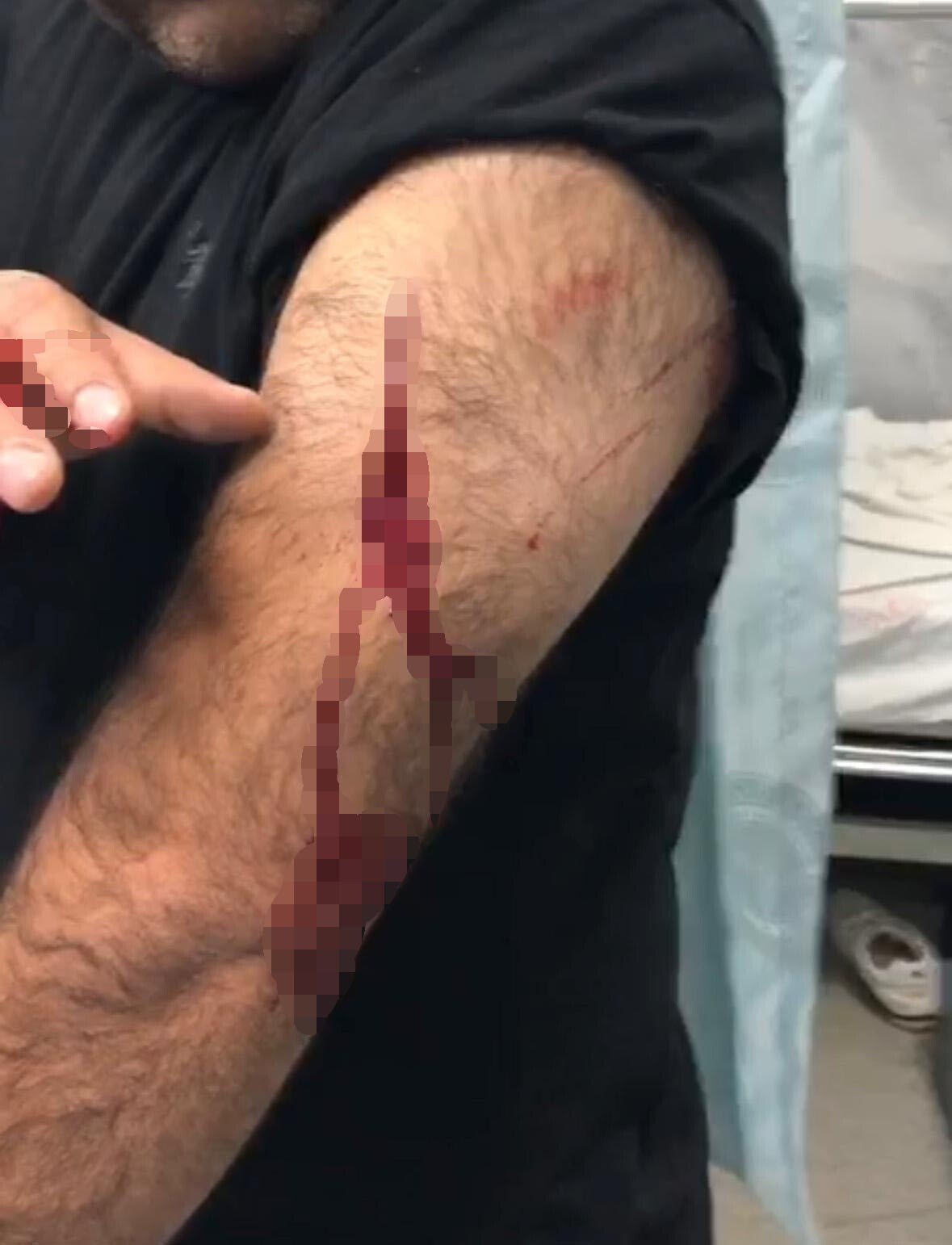 ŞANLIURFA’DA GÖREV YAPAN ÖĞRETMENE SOKAK ORTASINDA JİLETLİ SALDIRI