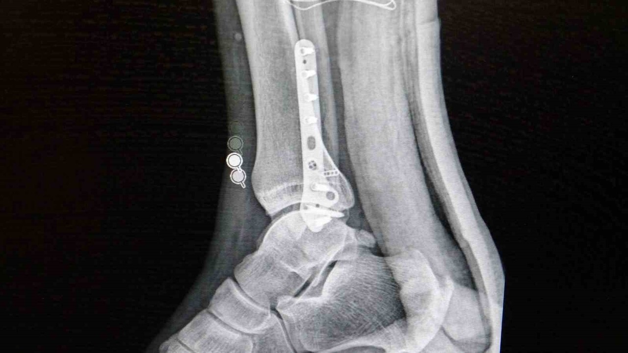 TUZLA DEVLET HASTANESİ ORTOPEDİ VE TRAVMATOLOJİ KLİNİK SORUMLUSU OP. DR. R. EMRAH DEMİRBAŞ...