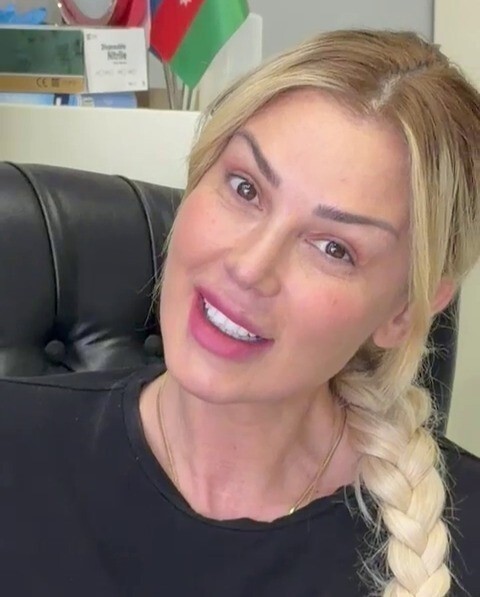 ÜNLÜ SANATÇI PETEK DİNÇÇÖZ’ÜN 8 AY ÖNCE GEÇİRDİĞİ ESTETİK OPERASYON SONRASI MAKYAJSIZ HALİ...