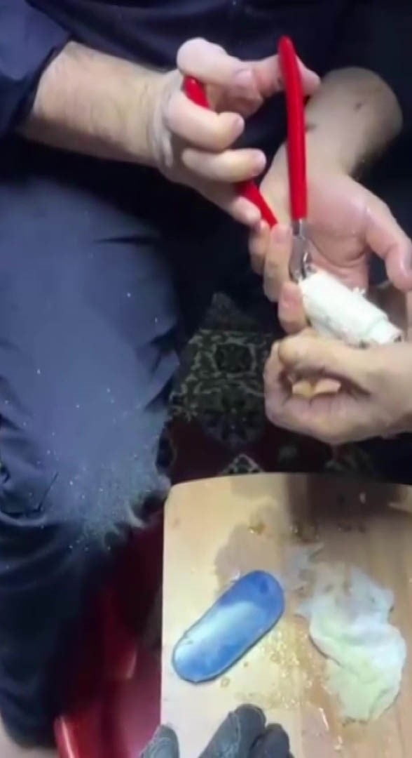 ADANA'DA PARMAĞINI KOMBİ BORUSUNA SIKIŞTIRAN BİR KİŞİNİN PARMAĞINDAKİ BORU, CANKUR EKİPLERİNCE...