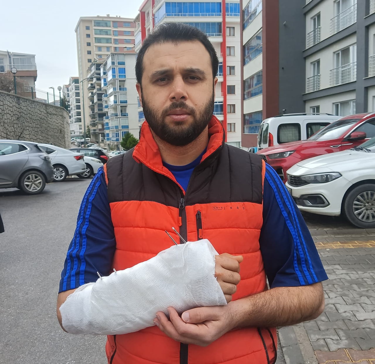 ANKARA’DA SAHİPSİZ KÖPEK SÜRÜSÜNÜN SALDIRISINDAN KAÇMAYA ÇALIŞIRKEN AYAĞININ KAYMASI SONUCU DÜŞEN...