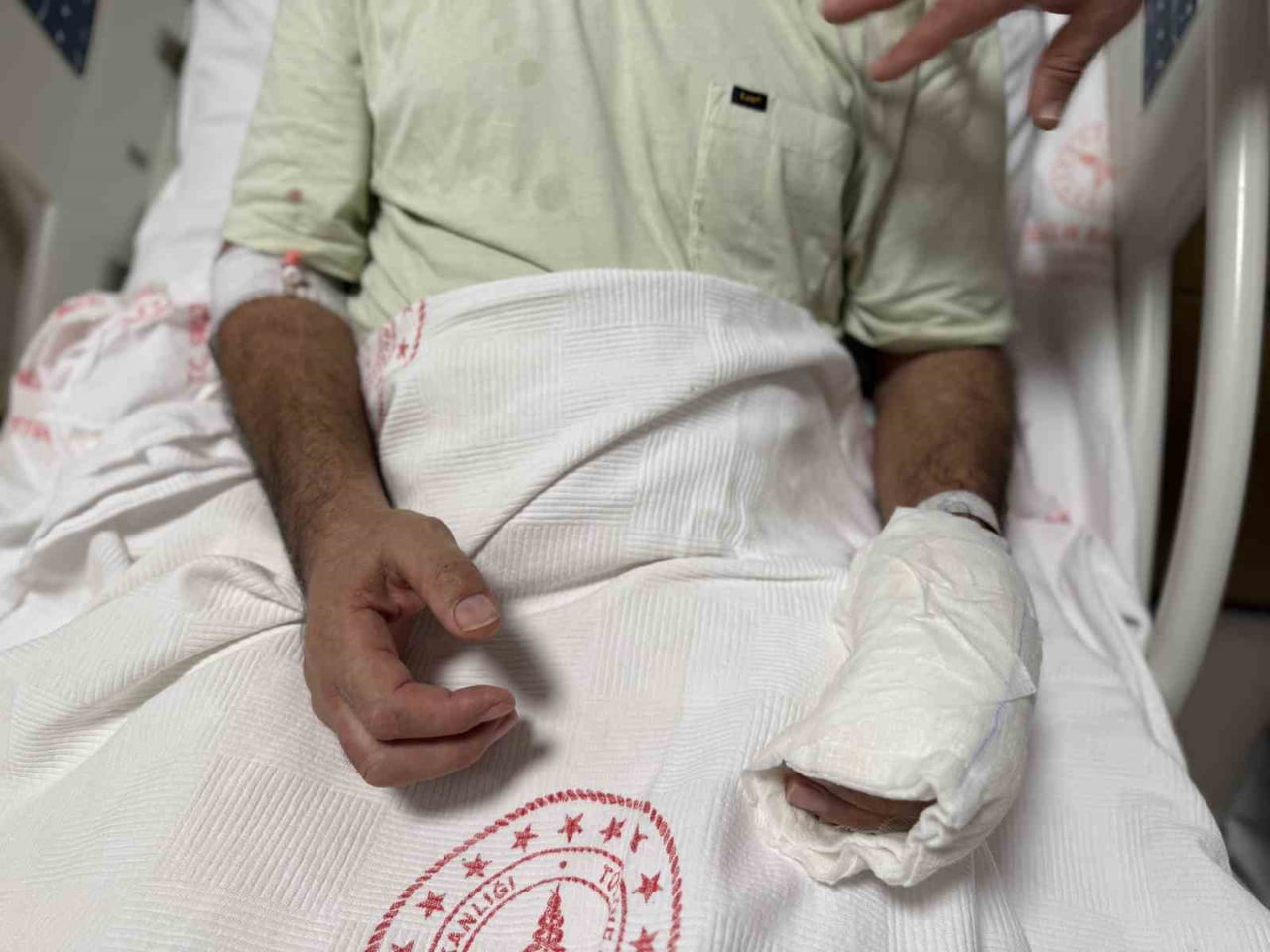 BACAĞINA KOYDUĞU SICAK SU TORBASI PATLAYAN 51 YAŞINDAKİ FARİZ AYDIN’IN VÜCUDUNUN YAKLAŞIK YÜZDE...