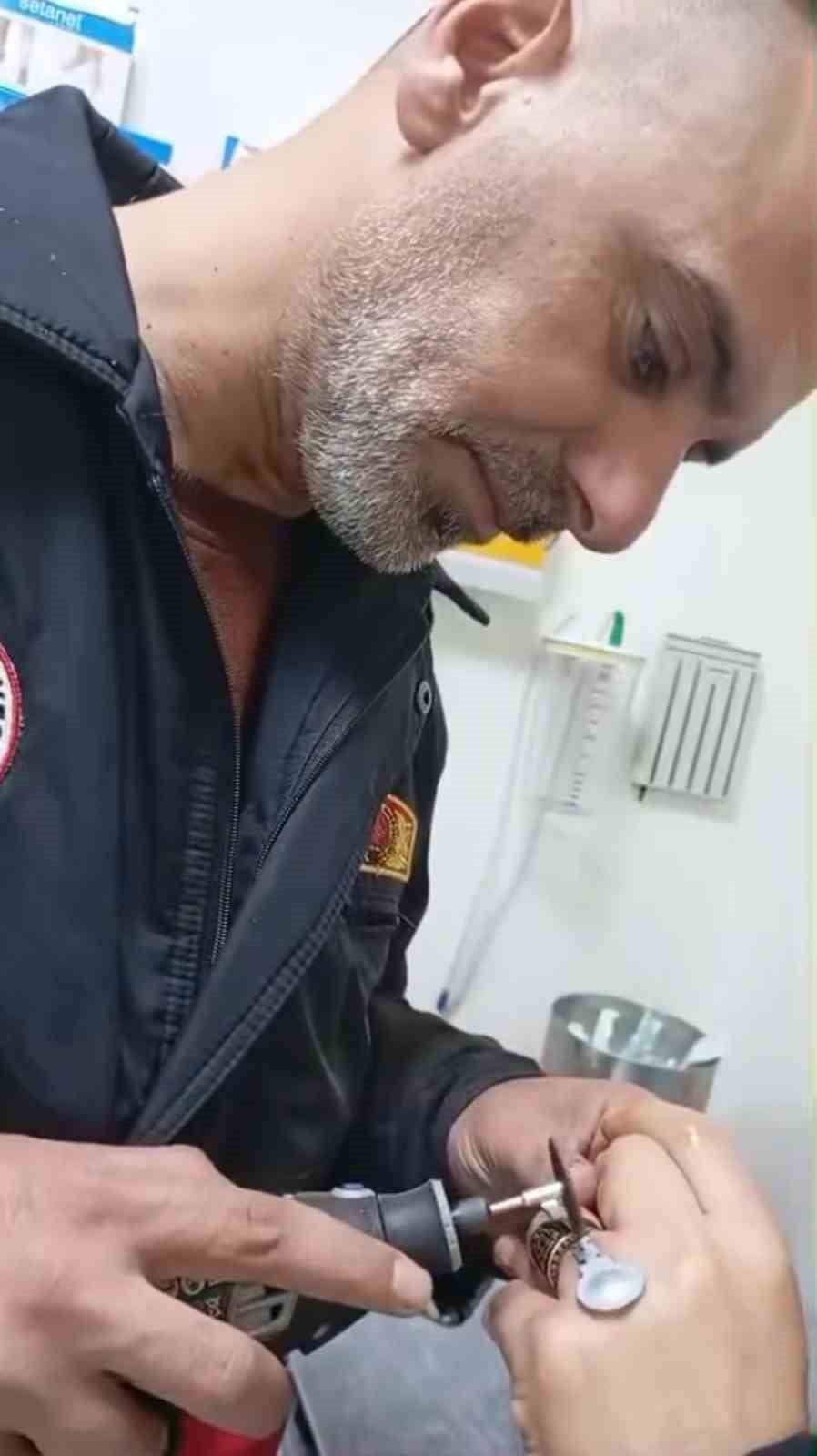 BİNGÖL'ÜN SOLHAN İLÇESİNDE PARMAĞINDA SIKIŞAN YÜZÜK NEDENİYLE HASTANEYE BAŞVURAN BİR VATANDAŞIN...