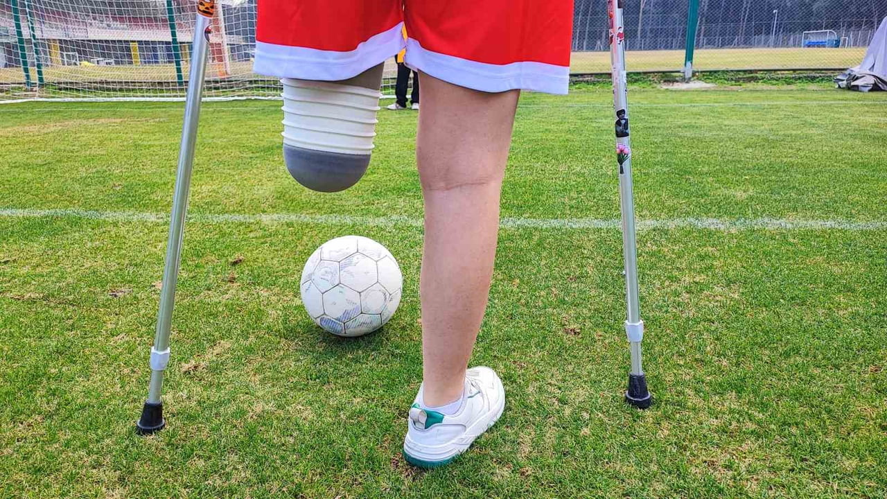 HATAY'DA DEPREMDEN 45 SAAT SONRA ENKAZDAN ÇIKARILARAK BACAĞI AMPUTE OLAN 16 YAŞINDAKİ TUĞBA AKIN...