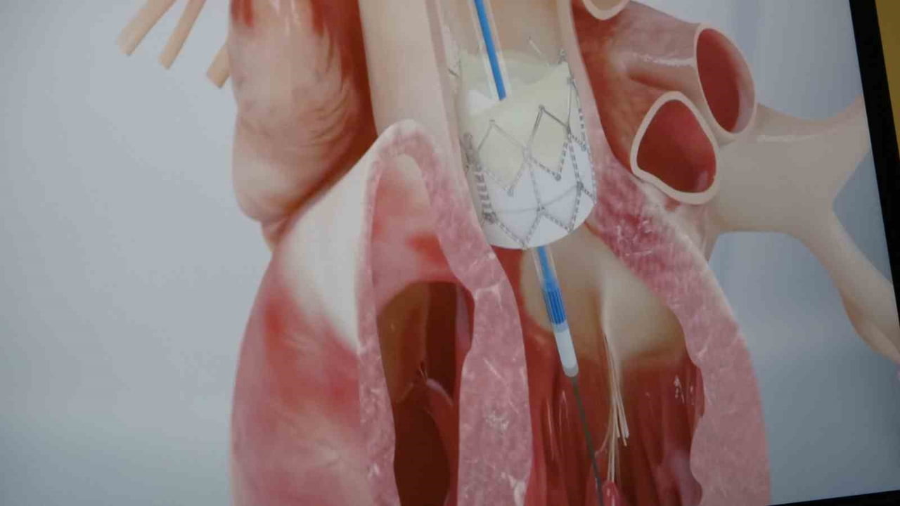 "GENÇLERDE ANİ ÖLÜMLERİN YÜZDE 90'I GENETİK NEDENLERDEN KAYNAKLANIYOR