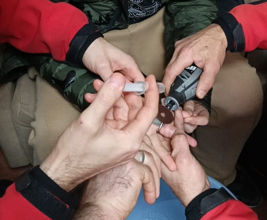 RİZE'DE OYUN OYNAMAK AMACIYLA MADENİ PARAYI PARMAĞINDA AKSESUARA DÖNÜŞTÜRMEYE ÇALIŞAN 10 YAŞINDAKİ...