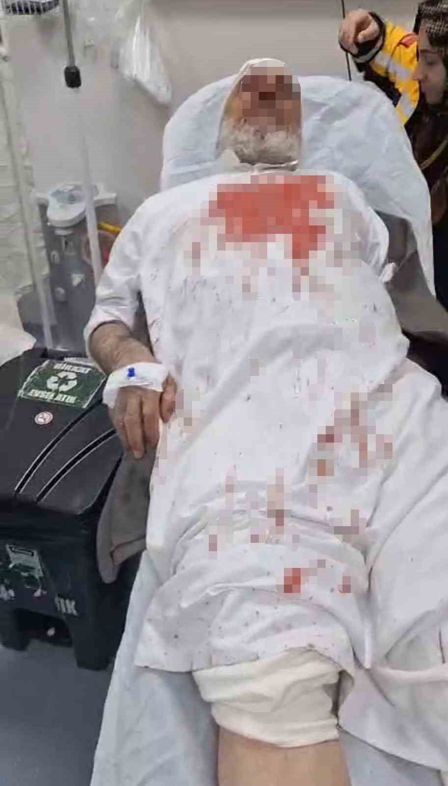 ŞANLIURFA'DA 72 YAŞINDAKİ YAŞLI ADAMI DARP EDEN 4 ŞÜPHELİ TUTUKLANDI