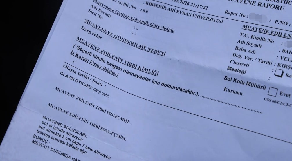 KIRŞEHİR’İN ÖZBAĞ BELDESİNDE, ÖZBAĞ BELEDİYE BAŞKANI İSMAİL ÇANAKÇI HAKKINDA, BİR ŞİZOFRENİ...