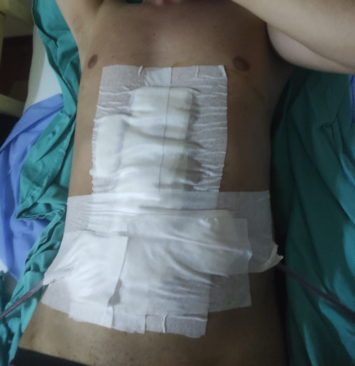 BALIKESİR’İN BANDIRMA İLÇESİNDE SAHİL BÖLGESİNDE BULUNAN HAVALI TÜFEKLE BALON ATIŞ ALANINDA...