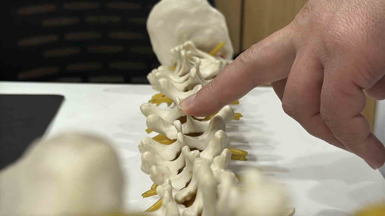 BEL FITIĞIYLA BENZER BELİRTİLER GÖSTEREN VE TEDAVİ EDİLMEDİĞİNDE KALICI HASARLARA YOL AÇABİLEN...