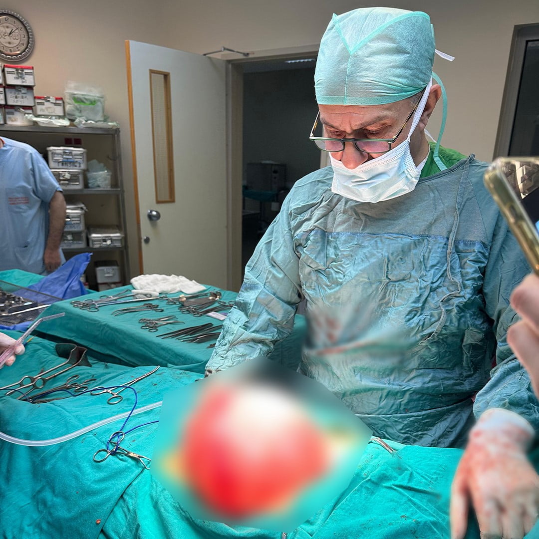 BOLU’DA FAZLA KİLOLARINDAN KURTULMAK İÇİN HASTANEYE BAŞVURAN LİSE ÖĞRENCİSİNİN KARNINDAN 3,5...