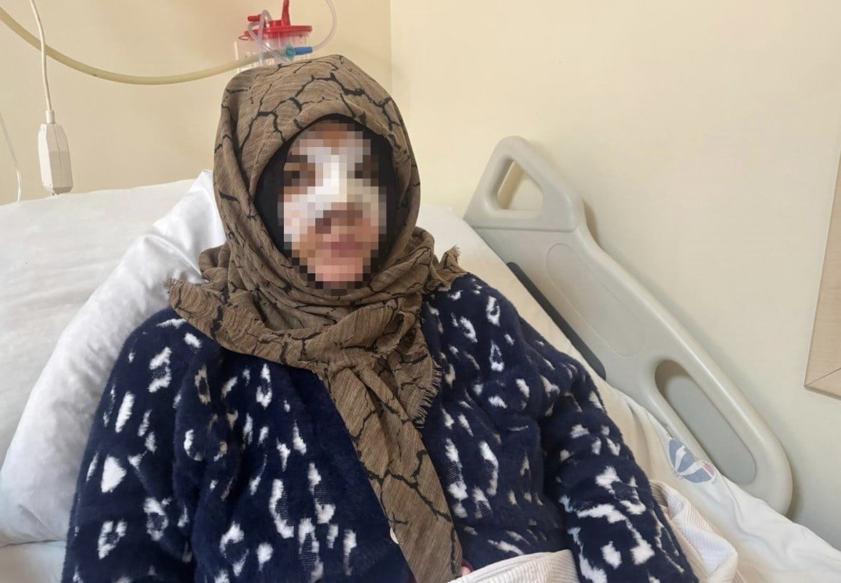 GAZİANTEP'TE BOŞANMAK İSTEYEN EŞİNİ, KAFASINA VE YÜZÜNE TAŞLA VURARAK DARP EDEN SANIK FEYZULLAH...