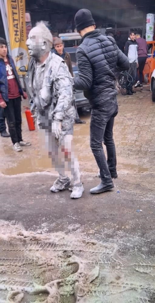 HASAN YÜNTEM PATLAMADA AĞIR YARALANMIŞTI (ARŞİV)