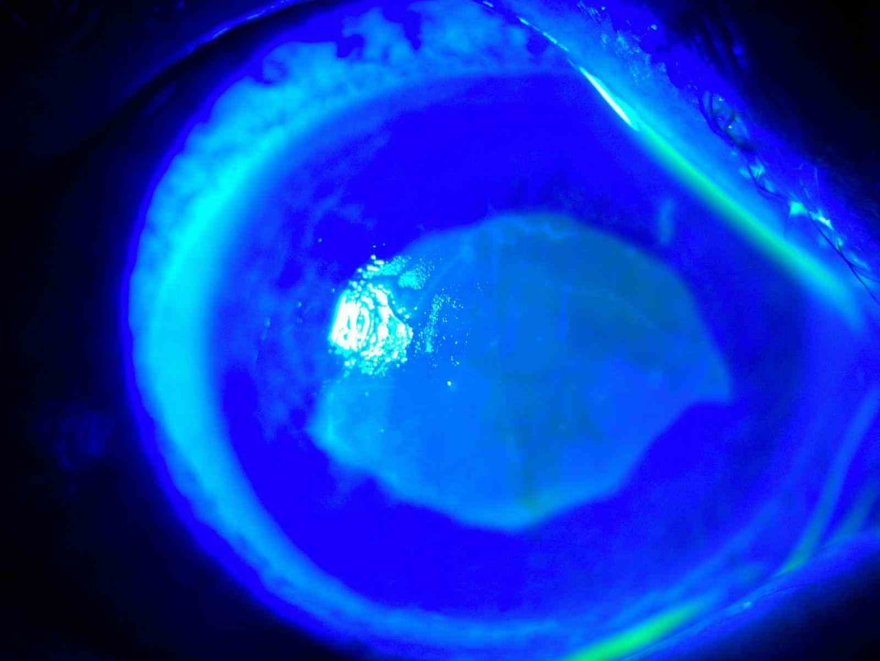 KOCAELİ'NDE YAŞAYAN 52 YAŞINDA KADIN, İDDİAYA GÖRE UZAĞI GÖREMEDİĞİ İÇİN KULLANDIĞI GÖZLÜKTEN...