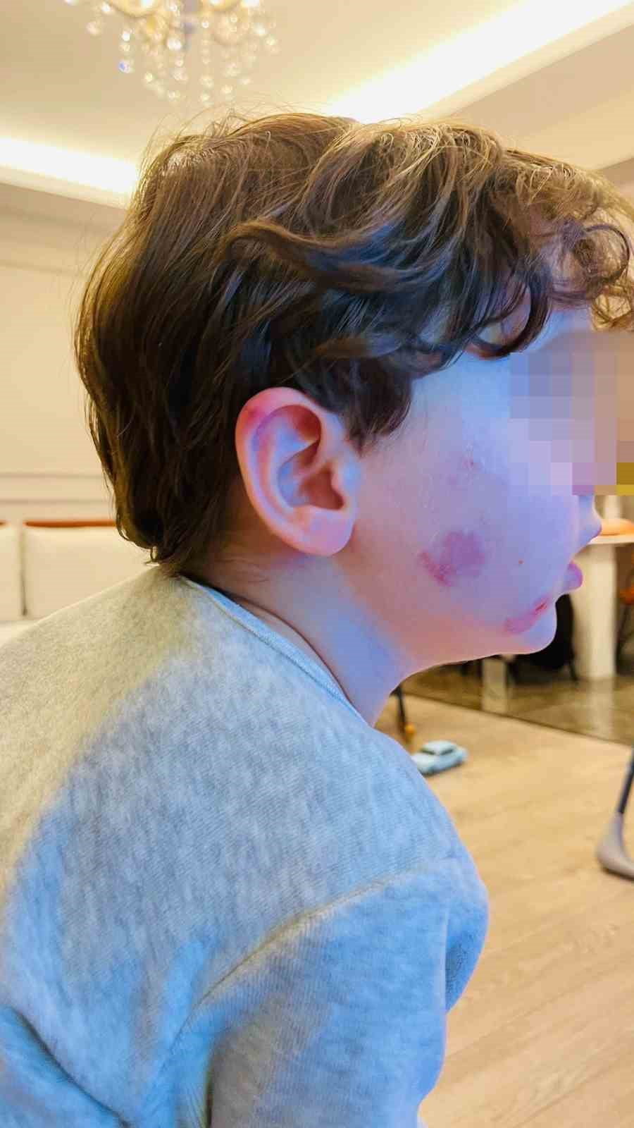 KREŞE BIRAKTIĞI ÇOCUĞUNU DARP EDİLMİŞ HALDE ALDI