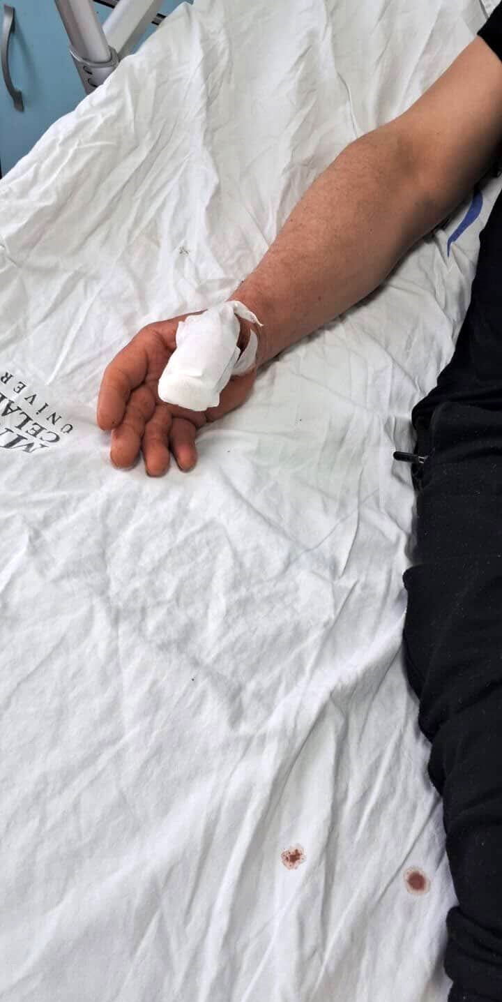 SALDIRIDA FERHAT BONCUK'UN SAĞ EL BAŞ PARMAĞI KOPTU