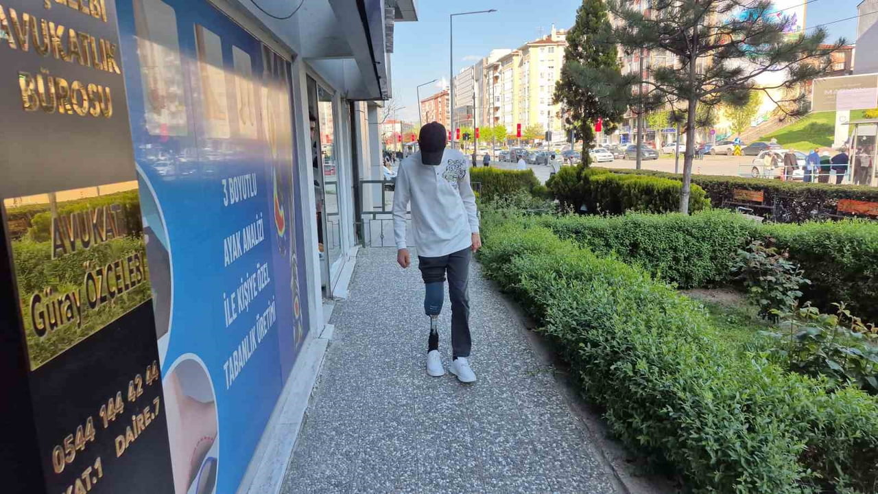 ESKİŞEHİR'DE KEMİK TÜMÖRÜ SEBEBİYLE SAĞ BACAĞI DİZ ALTINDAN AMPUTE EDİLEN 15 YAŞINDAKİ CÜNEYT...