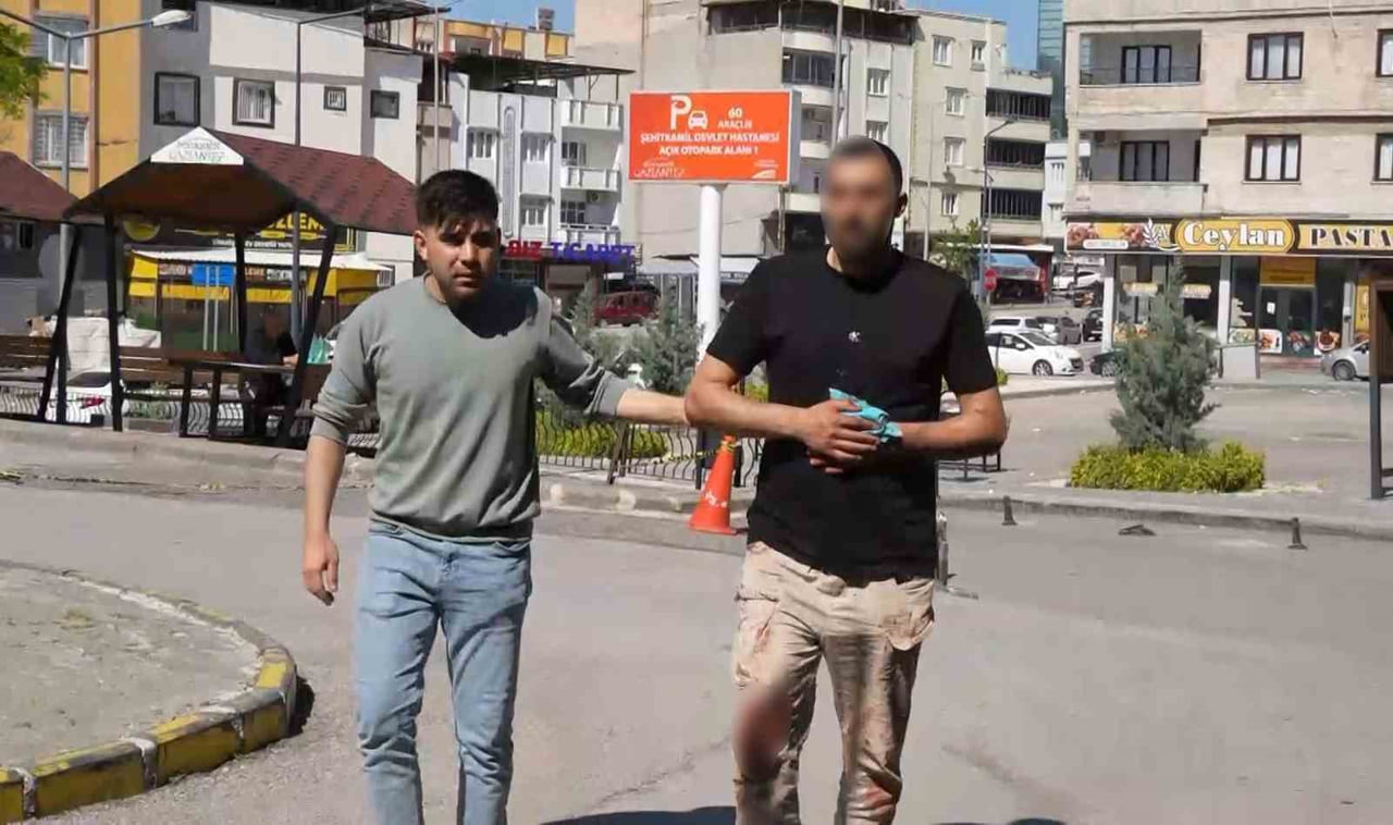GAZİANTEP'TE KURBAN KESİMİ SIRASINDA KENDİLERİNİ YARALAYAN VATANDAŞLAR, ACİL SERVİSLERDE YOĞUNLUĞA...