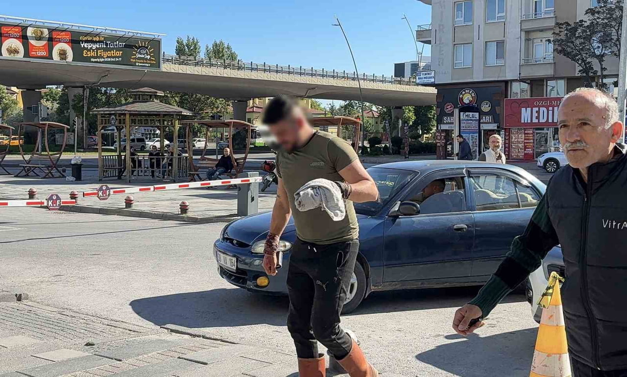 KAYSERİ'DE KURBAN KESİMİNDE KENDİNİ YARALAYAN ACEMİ KASAPLAR SOLUĞU ACİL SERVİSLERDE ALDI.