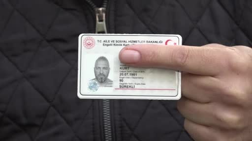 Temizlediği aracında 2 saat uyudu ölümden döndü, yüzde 90 görme kaybı yaşadı