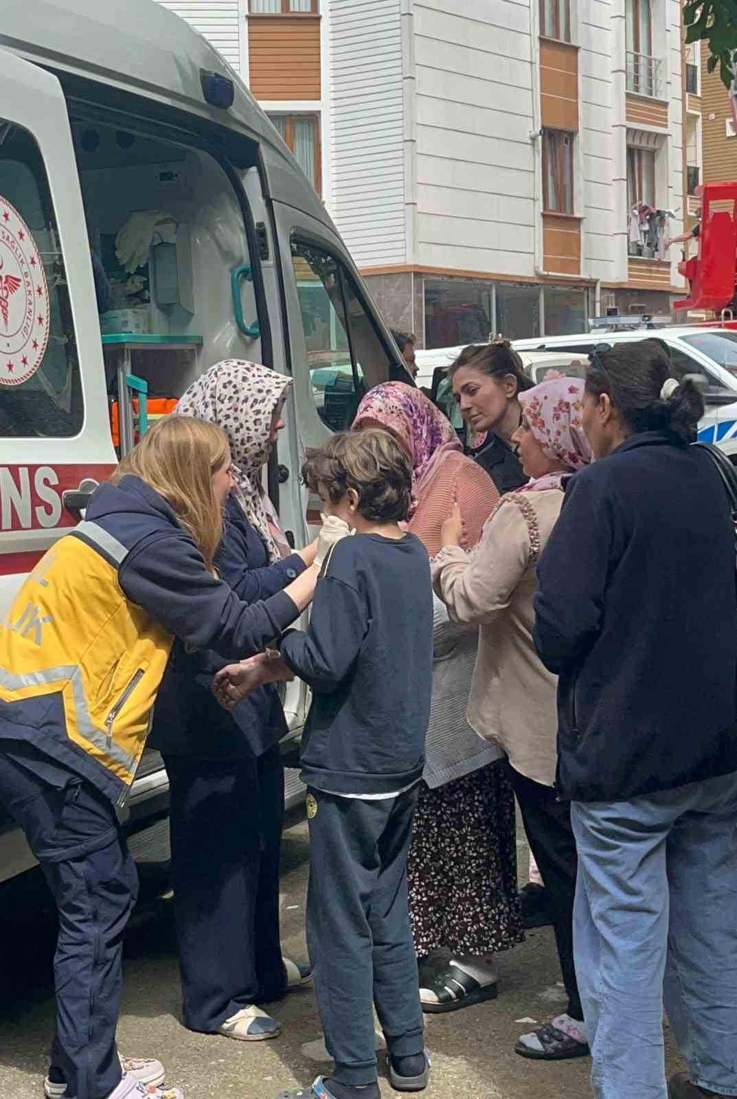 YANGINDA YARALANAN ÖZEL İHTİYAÇ SAHİBİ ÇOCUK GÖZYAŞLARINA BOĞULDU.