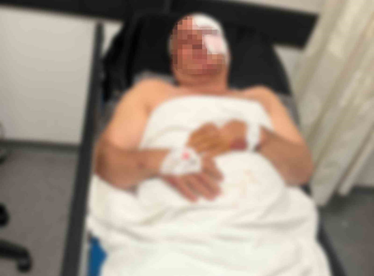 AYDIN'IN EFELER İLÇESİNDE MEYDANA GELEN MOTOSİKLET KAZASINDA BİR KİŞİ YARALANDI. HASTANEYE...