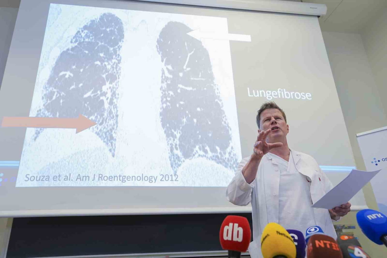 OSLO ÜNİVERSİTE HASTANESİ'NDEN PROFESÖR ARE HOLM AÇIKLAMA YAPTI