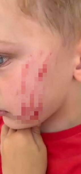 VAN’IN EDREMİT İLÇESİNDE SOKAKTA OYUN OYNAYAN 4 YAŞINDAKİ ÇOCUK, BİR KADININ SALDIRISINA UĞRADI....
