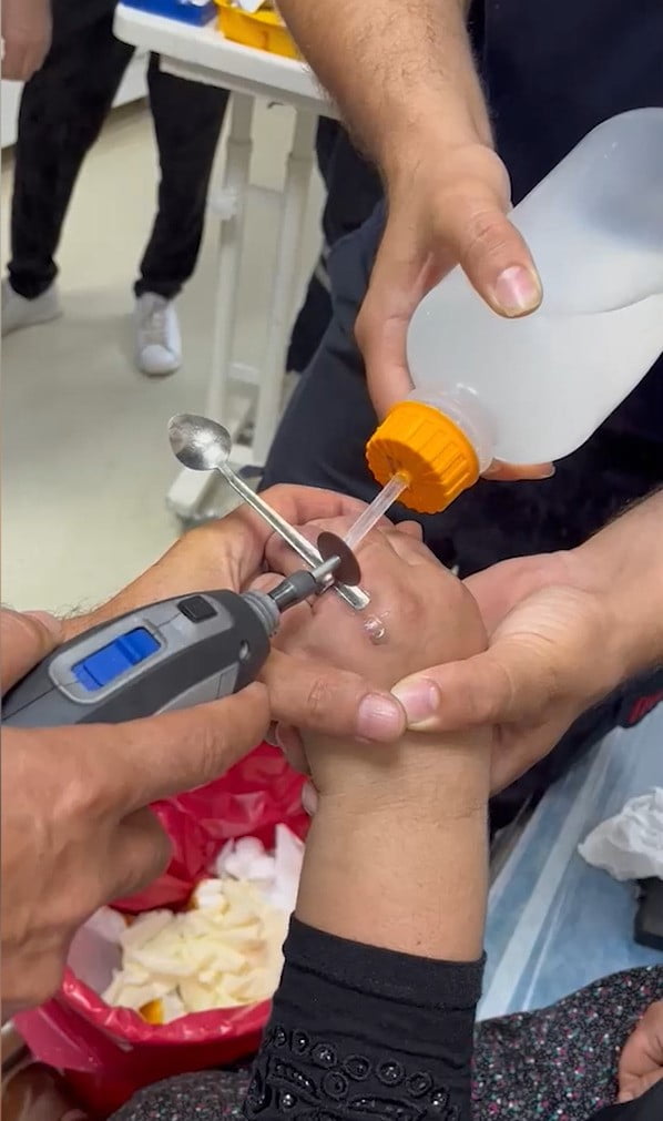 ADANA’DA BİR VATANDAŞIN PARMAĞINA SIKIŞAN YÜZÜK, İTFAİYENİN ÇALIŞMASI SONUCU...