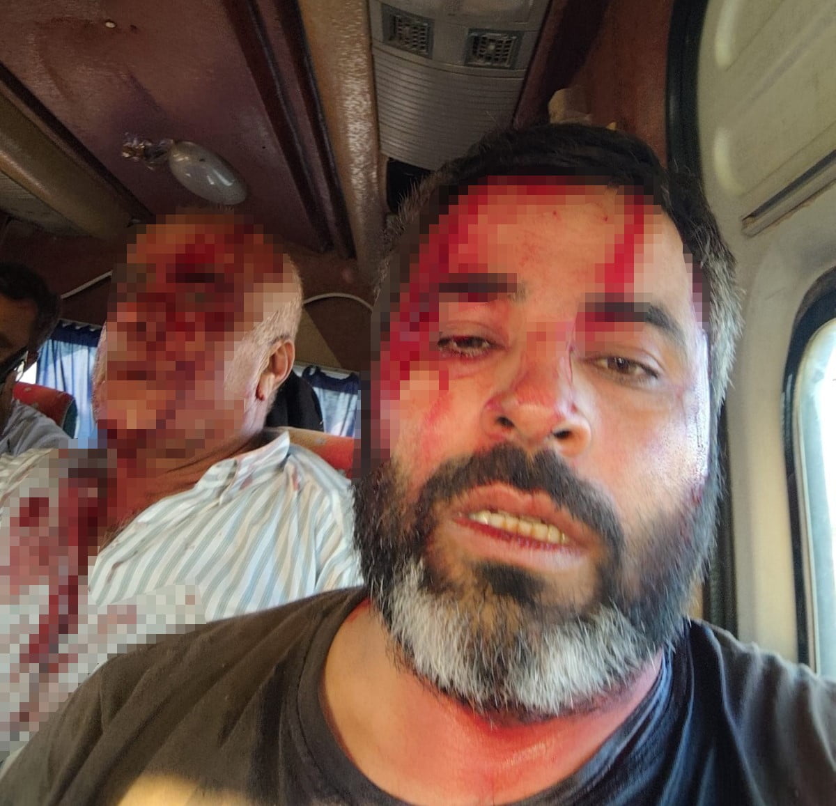 AKÇAKALE İLÇESİNDE ARAZİ ANLAŞMAZLIĞI NEDENİYLE İKİ GRUP ARASINDA ÇIKAN TAŞLI VE SOPALI KAVGADA 8...