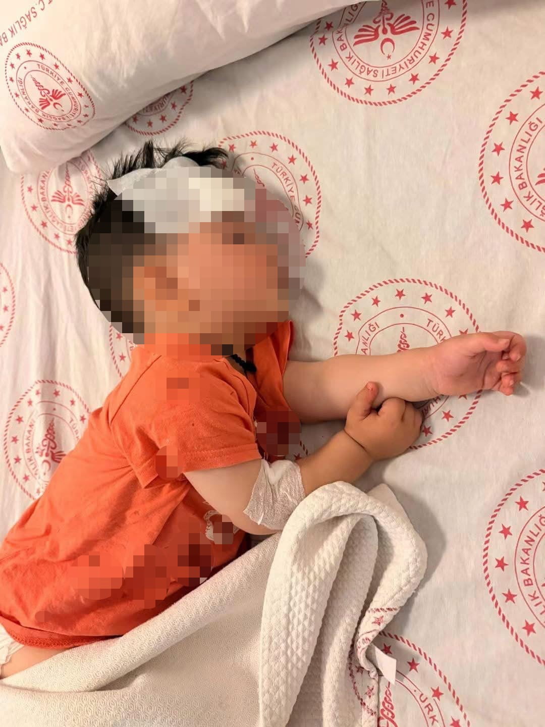 ŞANLIURFA'DA BAŞIBOŞ SOKAK KÖPEKLERİNİN SALDIRDIĞI 1 BUÇUK YAŞINDA ÇOCUK YARALANDI.