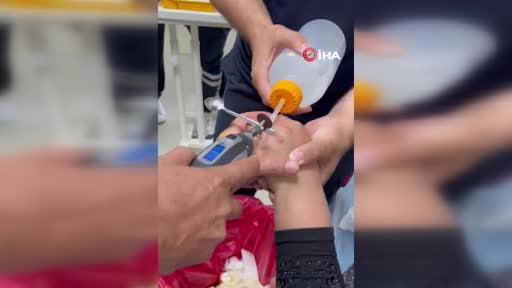 Yüzüğü parmağına sıkışan kadının yardımına itfaiye ekipleri koştu
