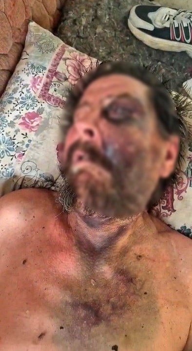 DARBEDİLEN VE METRUK BİR EVDE ÖLÜME TERK EDİLEN ADAMIN, SALDIRGAN KİŞİLERCE "SEN BENİM ABİMİN...