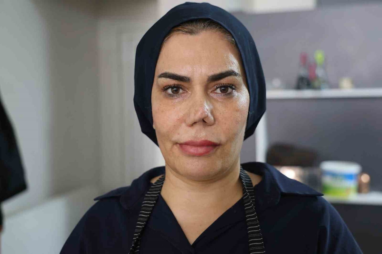 ELAZIĞ'DA 4 YIL ÖNCE EYŞAN ÖZGÜ BAKIM MERKEZİ'NDE BİR HASTANIN MÜDAHALESİ SONUCU BURNU KIRILAN...
