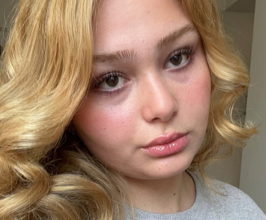 ESRA TURAN(18) HAYATINI KAYBETTİ.