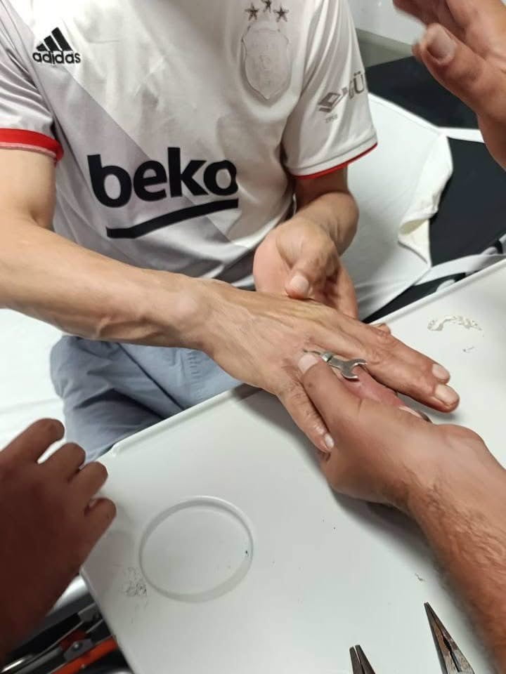 HATAY EĞİTİM VE ARAŞTIRMA HASTANESİ’NDE PARMAĞINA YÜZÜK SIKIŞAN VATANDAŞIN İMDADINA EKİPLER...