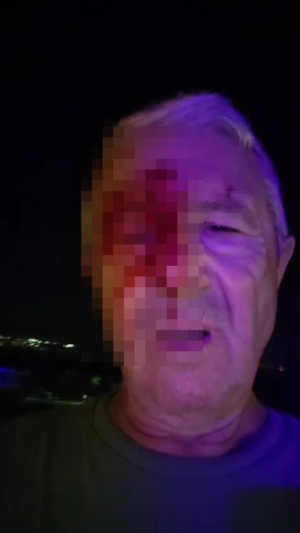 KOCAELİ'DE İHA MUHABİRİ TAYYAR ÖZTOPRAK, OLAY YERİNDE İKİ KİŞİNİN SALDIRISINA UĞRADI. ÖZTOPRAK'IN...