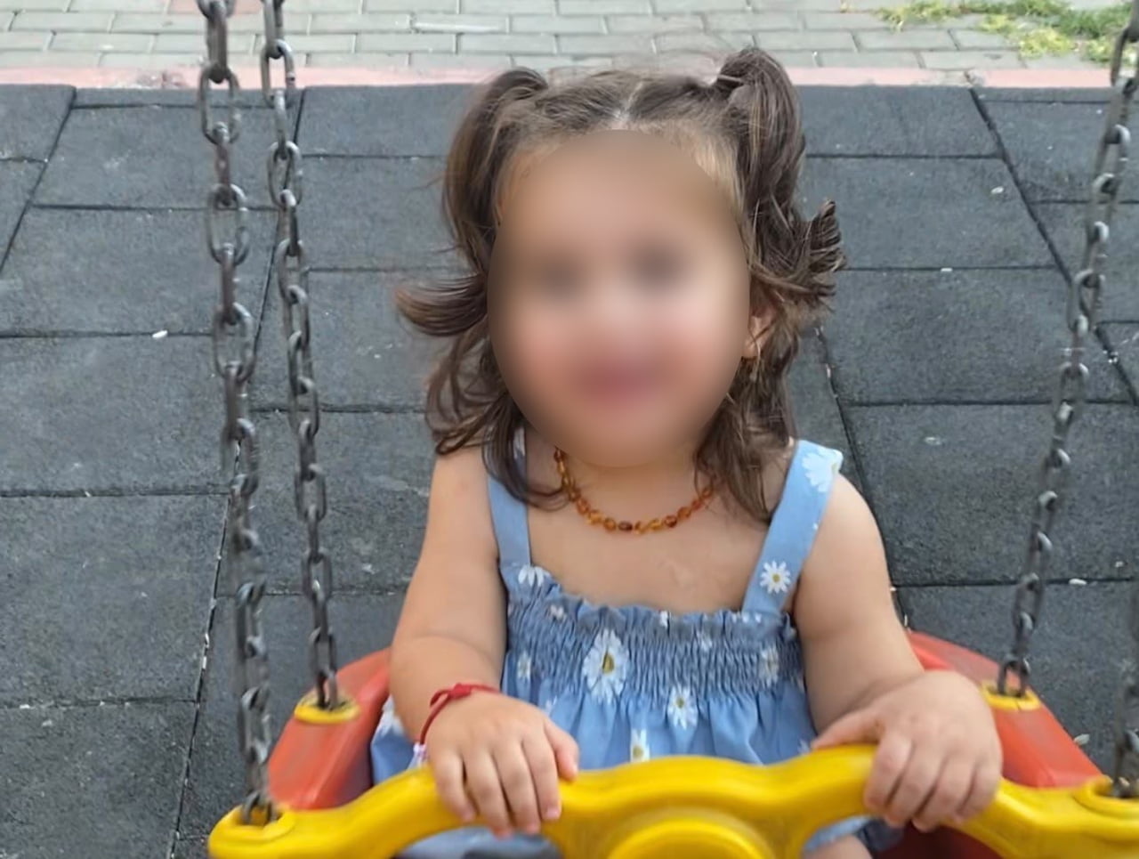 MERSİN'DE 9 AYLIKKEN MİSAFİRLİKTE PATLAYAN DOMATES KONSERVESİ NEDENİYLE YÜZÜ VE VÜCUDUNDA 3....